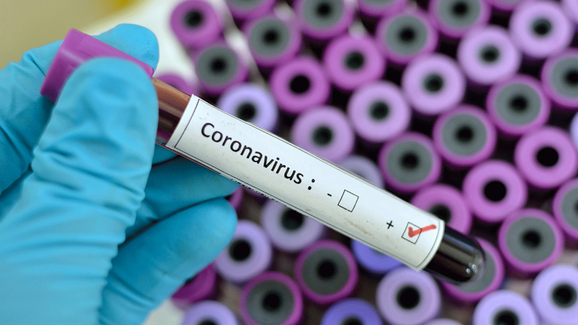 Coronavirus Test